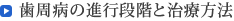 歯周病の進行段階と治療方法