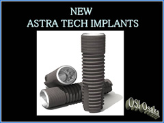 イメージ：ASTRA TECH IMPLANT01